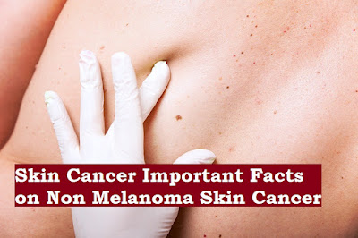 skin cancer death rate what is the number one risk factor for skin cancer skin cancer statistics what are the symptoms of skin cancer at what age does skin cancer typically occur most common places for skin cancer skin cancer statistics 2015 melanoma statistics by age