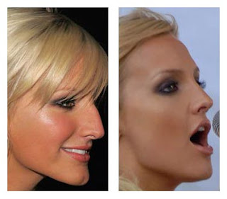 Ashlee Simpson Nose Job Plastic Surgery