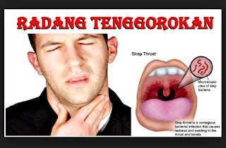 Tanaman Obat Herbal Tanaman Obat Herbal