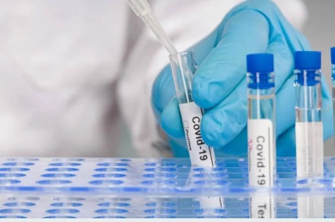 Cinco muertes y 788 nuevos casos de coronavirus se reportan este miércoles