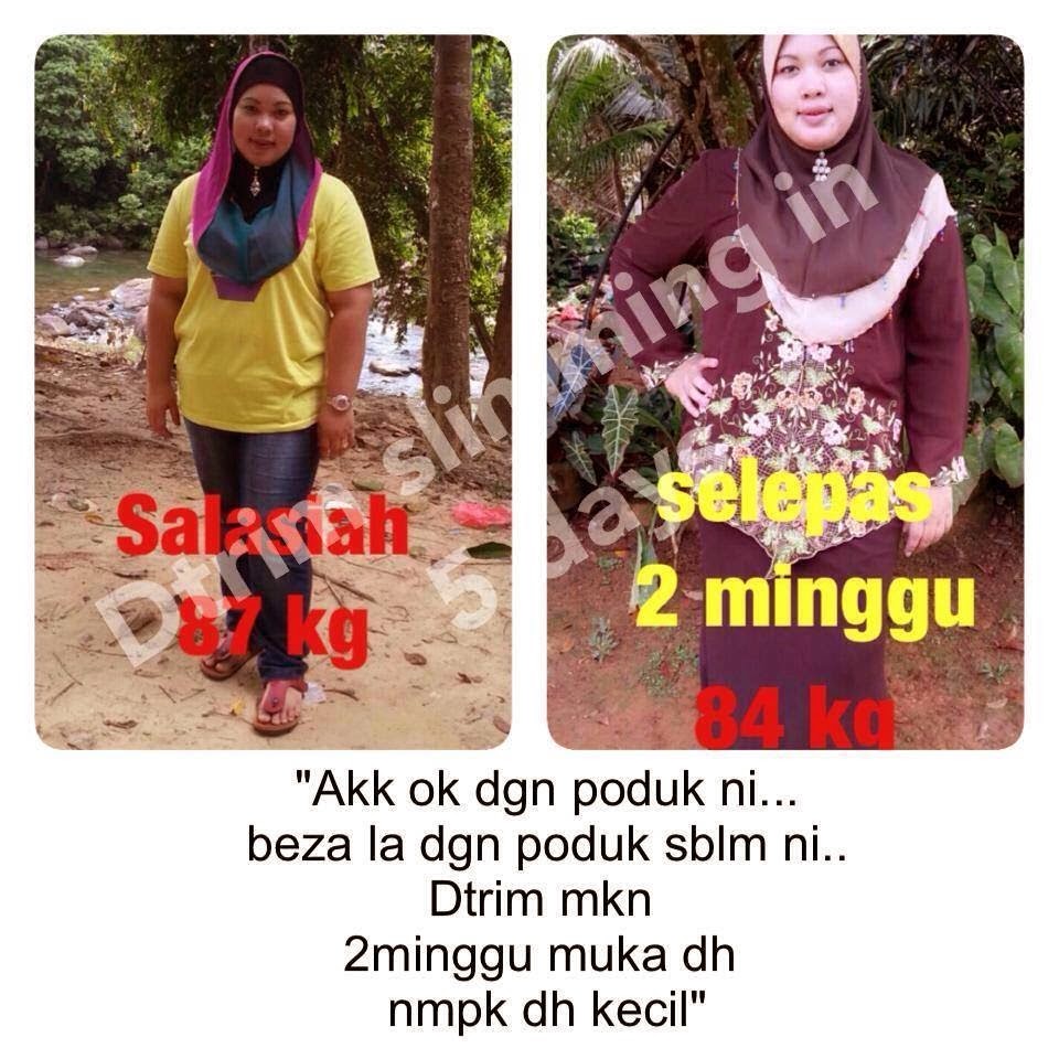 Dtrim Slimming Expert - Menyelesaikan Masalah Obesiti Anda 