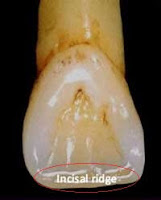 landmarks of the teeth | Elevated landmarks & Depresses landmarks.