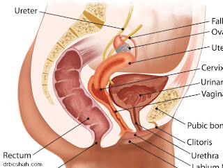 cystoscopy 