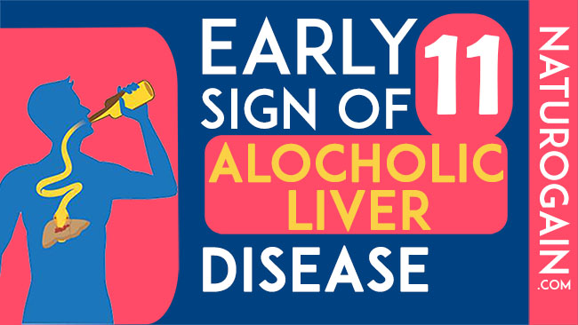 signs of alcoholic liver disease