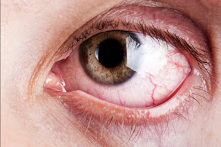 What are the signs of retina problems?