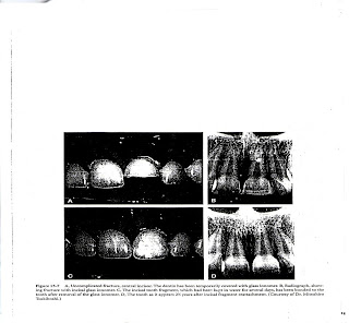 Trauma Endodontics