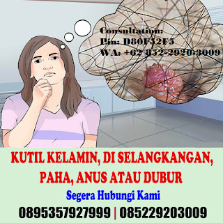 Obat Kutil Kelamin