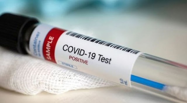 India tests  'COVAXIN' in Humans; The trial of COVID-19 Vaccine Developed in India: First dose was given to a man of 30
