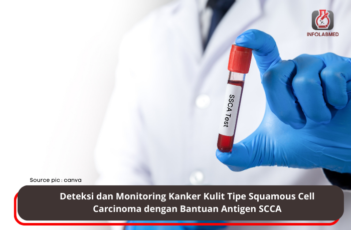 Deteksi dan Monitoring Kanker Kulit Tipe Squamous Cell Carcinoma dengan Bantuan Antigen SCCA