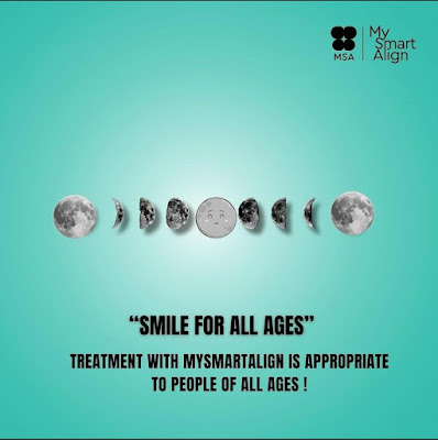 Clear Aligners