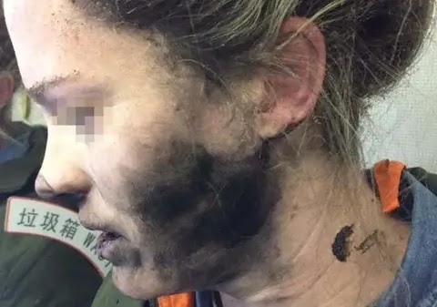 A MAN PASSED OUT AFTER A BLUETOOTH HEADPHONES BLAST