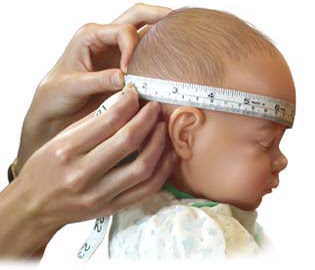 [10000 téléchargés √] périmètre cranien bébé 3 mois trop grand 154328-Périmètre cranien bébé 3 mois trop grand