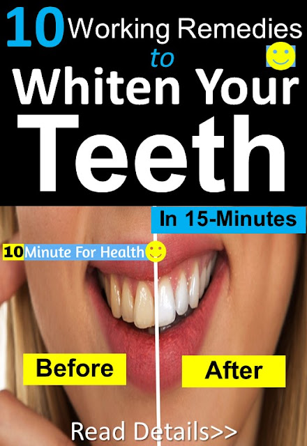 How to whiten teeth, teeth whitening home remedies, whiten your teeth in 5 minutes, how to get rid of yellow teeth, fast teeth whitening remedies