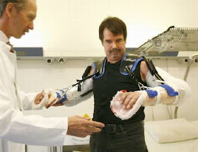 Karl Merk - Double Arm Transplant In The World