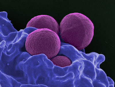 Staphylococcus aureus skin