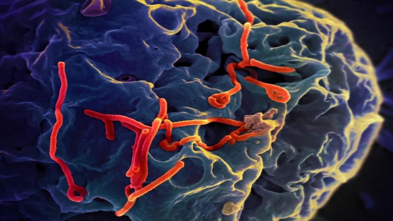 O vírus Ebola pode causar infecções latentes em sobreviventes que podem desencadear novos surtos. INSTITUTO NACIONAL DE ALERGIA E DOENÇAS INFECCIOSAS / INSTITUTOS NACIONAIS DE SAÚDE / FLICKR ( CC BY-NC 2.0 )