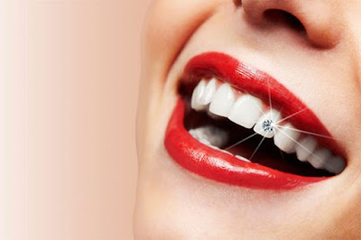 Đính đá răng có tác dụng gì?