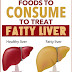 Evidence-Based Fatty Liver Diet – Diet Plan And Foods To Eat And Avoid