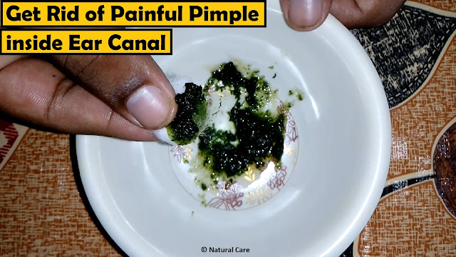 Get Rid of Painful Pimple inside Ear Canal