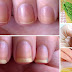 How to Grow Nails Faster & Stronger 7 Best Home Remedies