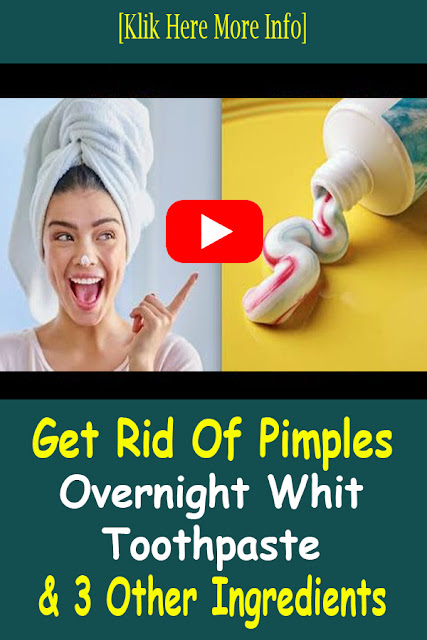 How To Get Rid Of Pimples Overnight With Toothpaste