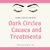 Dark Circles Under Your Eyes - Causes and Treatments