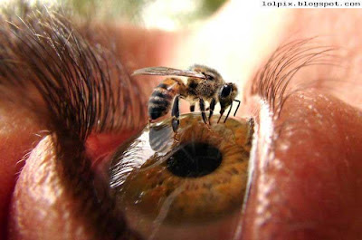 picture of wasp stinging an eye ball