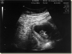 SecondScan01