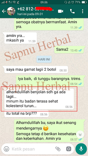 Obat Benjolan di Kaki / di Tangan | 100 % ALAMI dan MUJARAB