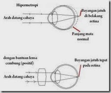 Kelainan-kelainan pada Mata (8)