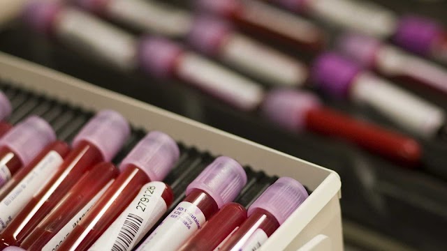 Novo exame de sangue poderá detectar 8 tipos de câncer