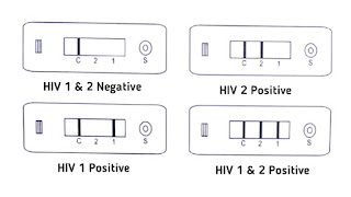 HIV-test, HIV, AIDS, HIV-test-in-hindi,