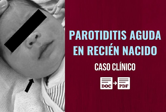 PDF: Parotiditis aguda en recién nacido