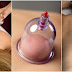 9 REASONS YOU SHOULD TRY CUPPING THERAPY