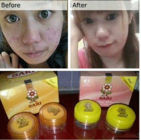 krim pemutih wajah cream sari asli | Jual Kosmetik Online Murah