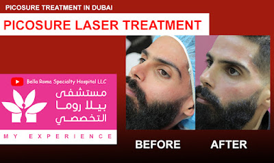 PicoSure Laser Treatment | PicoSure Procedure Bella Roma Dubai