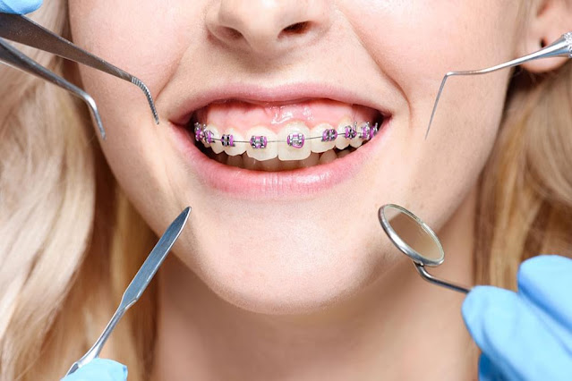 Orthodontist Melbourne