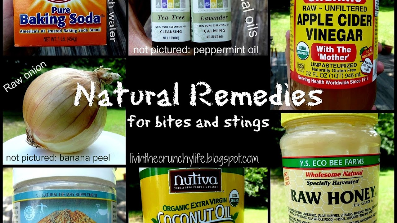 Yellow Jacket Home Remedies
