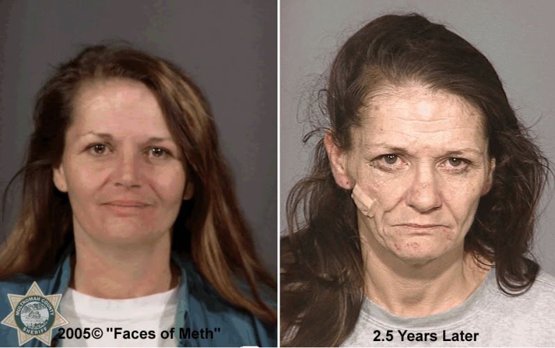 meth effects on the body