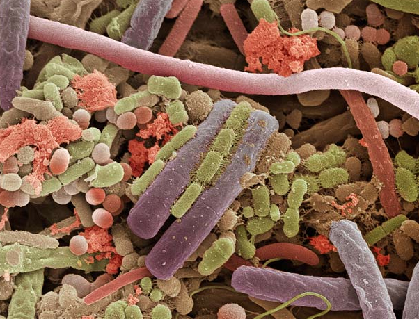 Bacterias en la lengua