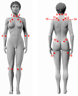 Fibromiyalji Sendromu Tedavisi