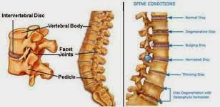 http://www.gohealth.in/treatment/spine-surgery/cost/