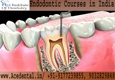 Endodontic Courses in India