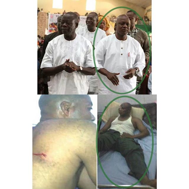 Photos: Adams Oshiomhole’s deputy escapes assassination