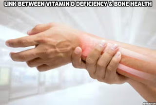 The link between vitamin D deficiency and bone health. The post sheds light on the consequences of vitamin D deficiency on bone health, such as increased risk of fractures and weakened bones. It also discusses the factors that contribute to vitamin D deficiency and provide tips on how to prevent and address this issue.   #VitaminDDeficiency, #HealthyBonesHealthyLife, #SunshineVitamin, #VitaminDBoost, #HealthyBones, #SunshineVitamin, #BoneHealthMatters, #StrongBones, #VitaminDDeficiency, #HealthyLiving, #BoneStrength, #SunshineAndBones, #VitaminDForHealth, #BoneHealthTips #VitaminDImportance #HealthyLifestyle #BoneHealthAwareness #VitaminDForBones, #StrongAndHealthy, #BoneHealthFacts, #VitaminDResearch, #HealthyBonesHealthyLife, #BoneHealthJourney,