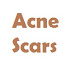 Ayurvedic Treatment For Acne Scars(पिंपल्स के निशानों का आयुर्वेदिक इलाज)