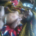 Lord is Great!!! WOMAN DELIVERS BABY WITHOUT FACE (PIC)