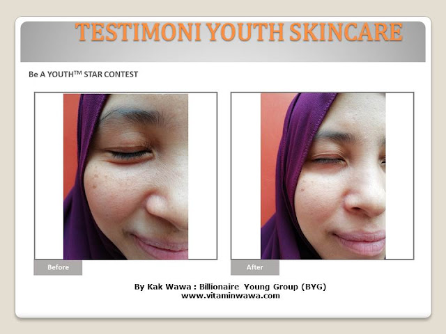 34 Testimoni Youth Skincare Shaklee Terbaru, Youth skincare shaklee, testimoni youth skincare shaklee, Youth Skincare Shaklee : Harga dan Review Pengguna Youth Shaklee, testimoni youth skincare shaklee, testimoni youth skincare shaklee