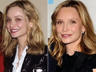 Calista Flockhart Plastic Surgery Nose Job and Lips Augmetation Before and After