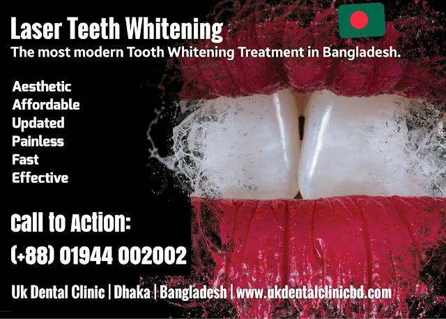 Best Dental Clinic in Bangladesh is Uk Dental Clinic at Uttara Dhaka